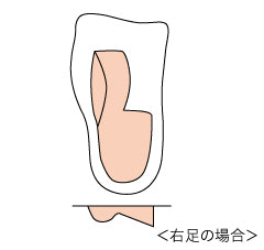 ソルボ疲労対策アーチウェッジヒールタイプ