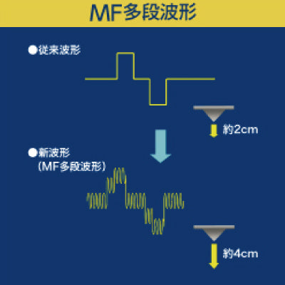 アステオ Sタイプ