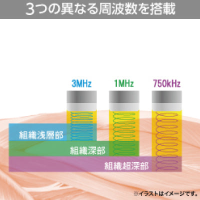 ULTRASON RE-3000(フルセット)