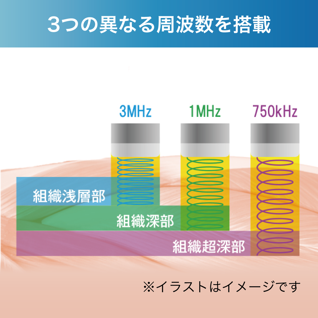 ULTRASON RE-3000(フルセット)