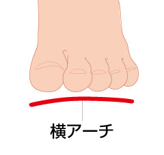 ソルボヨコアーチサポーター