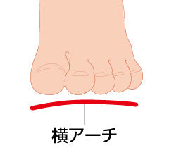 ソルボヨコアーチサポーター