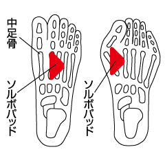 ソルボヨコアーチサポーター薄型
