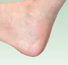 マルチフィックス®・ロール