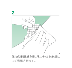 マルチフィックス®・ロール