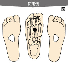 D-横軸アーチパッド