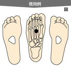 D-横軸アーチパッド