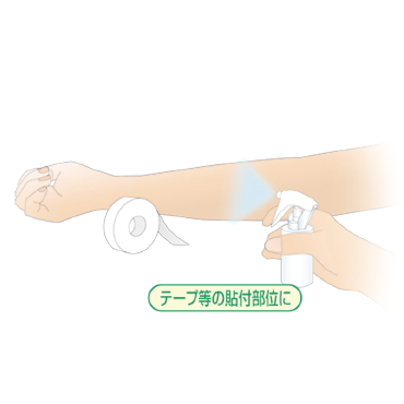 リモイス®コート