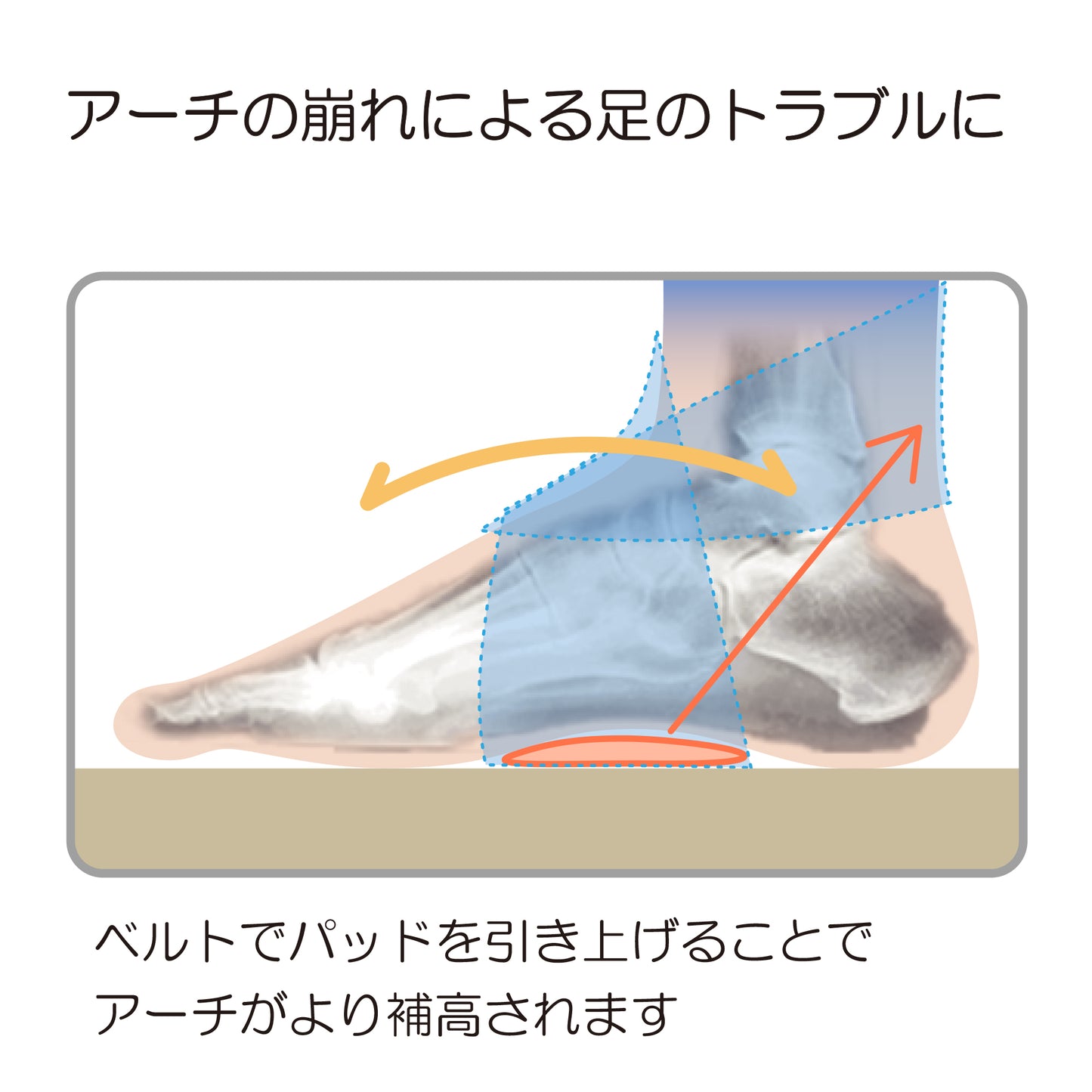 ソフラウルファー®アーチ ローパッド