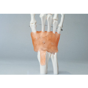 手関節模型