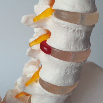 大腿骨付脊髄帯　神経整体模型