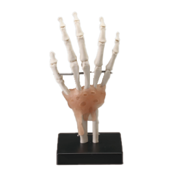 手関節模型