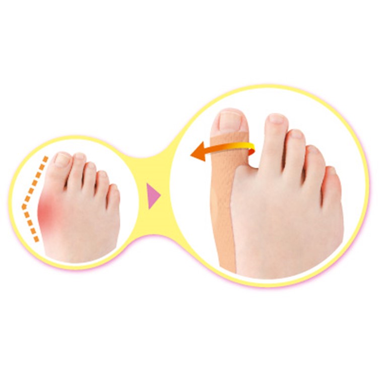 ソルボおでかけテープ外反対策（パッド付き）