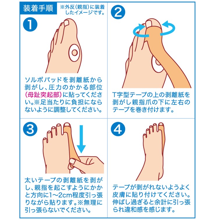 ソルボおでかけテープ外反対策（パッド付き）