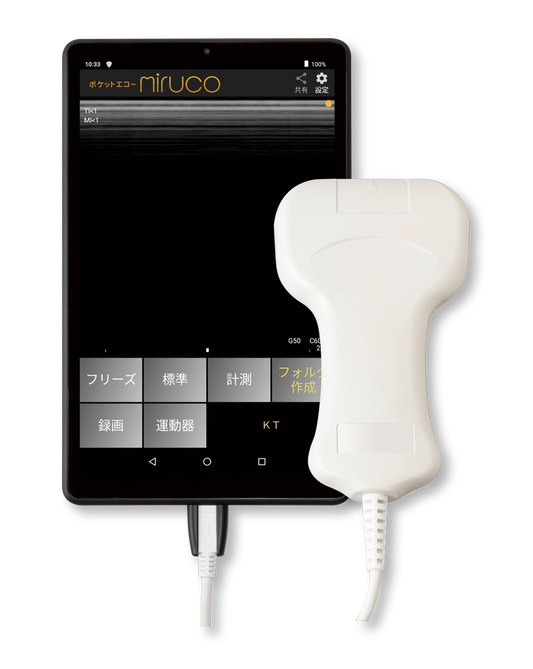 ポケットエコーmiruco
