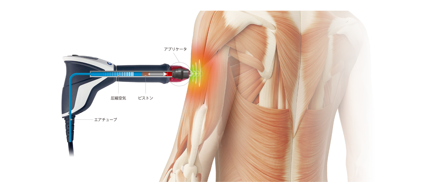ショックマスター