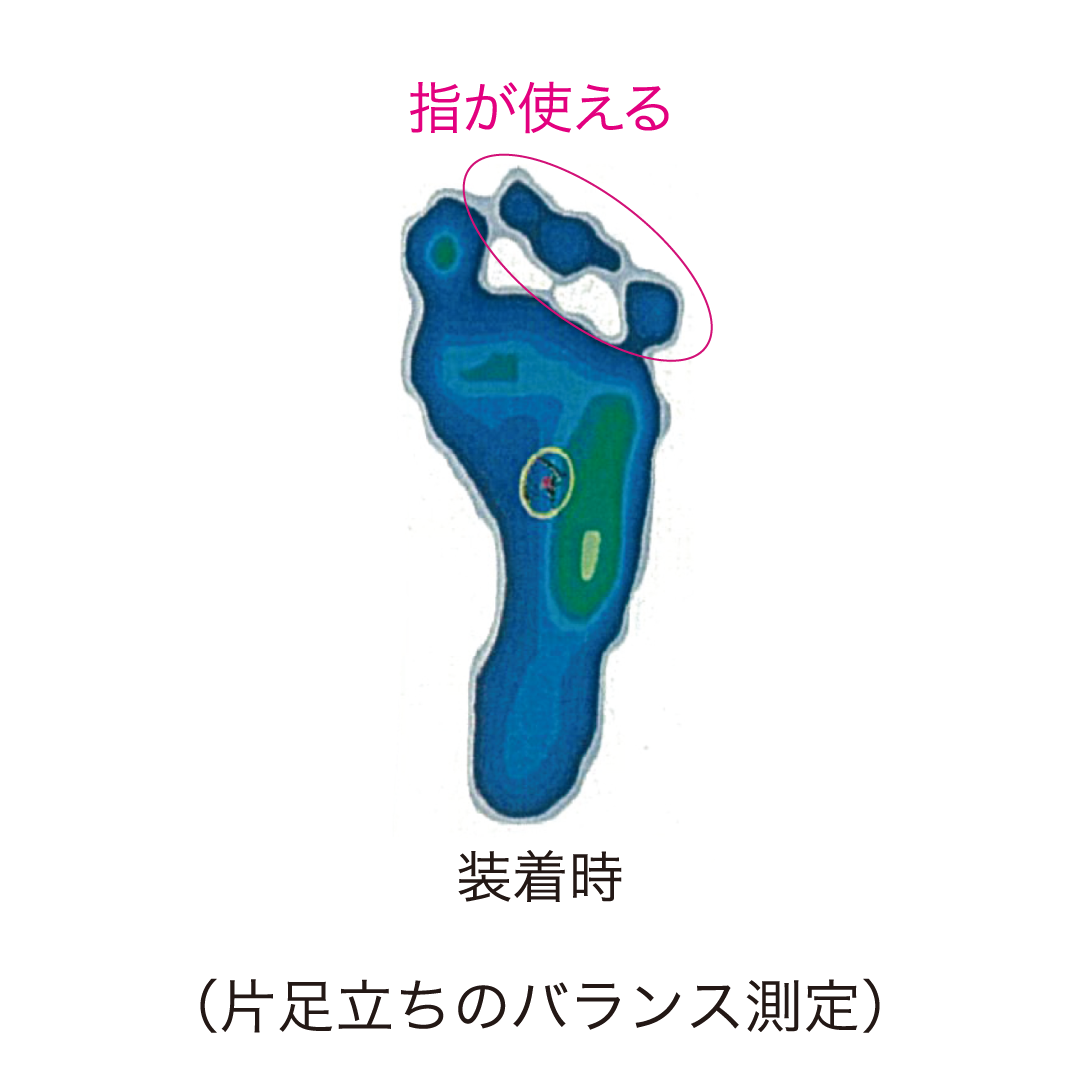 シンデレラ