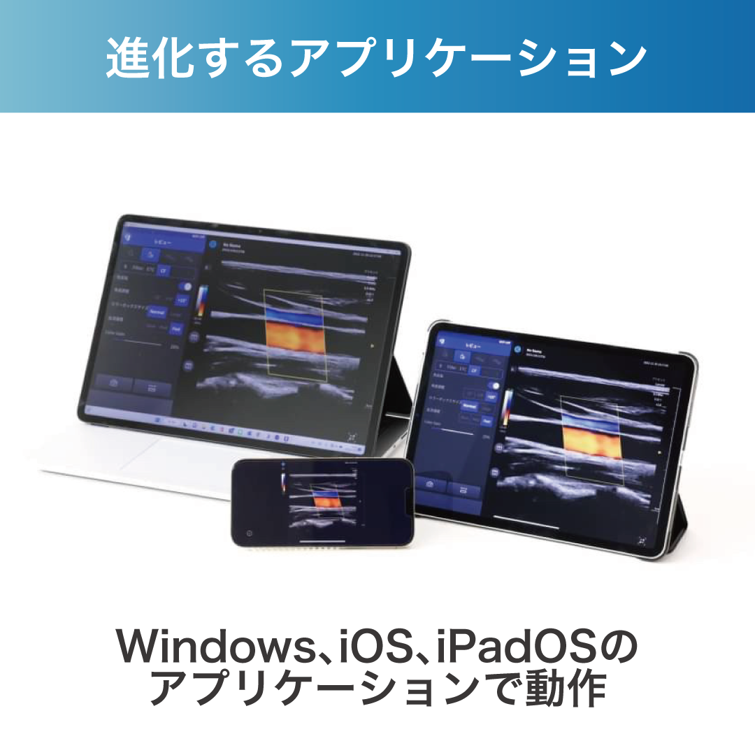 超音波画像診断装置 SONON(ソノン) 500L