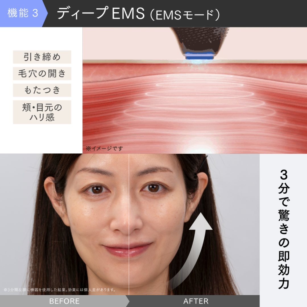 MYTREX MiRAY ONE（マイトレックス ミライワン)