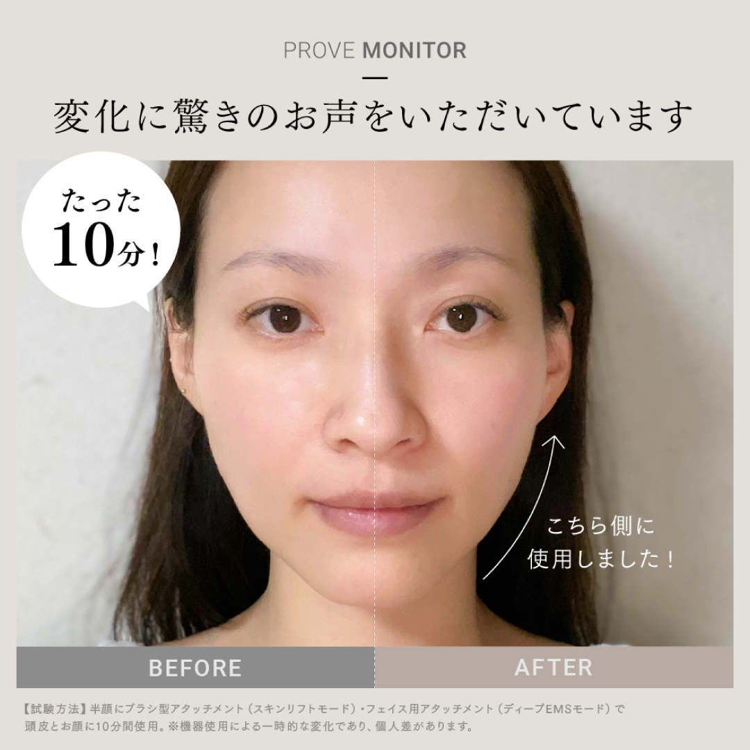MYTREX PROVE（マイトレックス プル―ヴ）